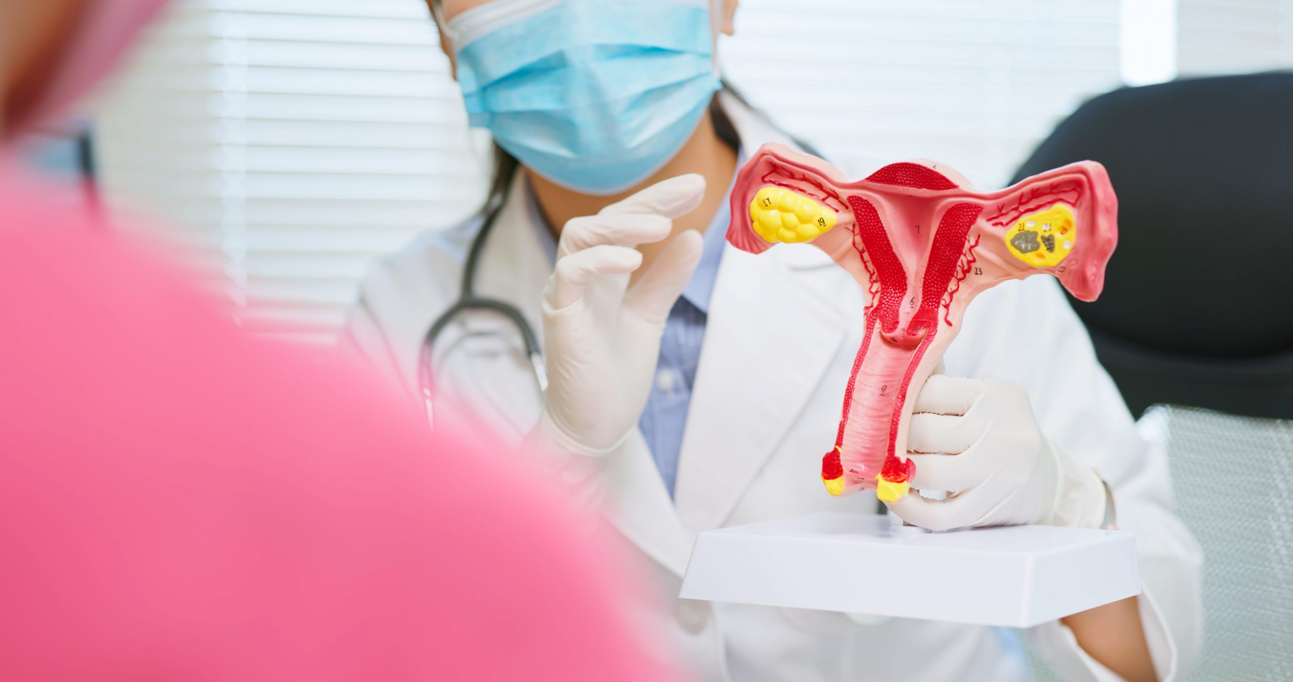 Síndrome do Ovário Policístico