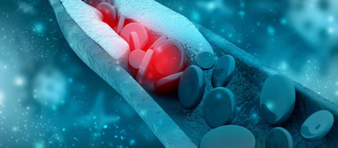 Tireoide e colesterol